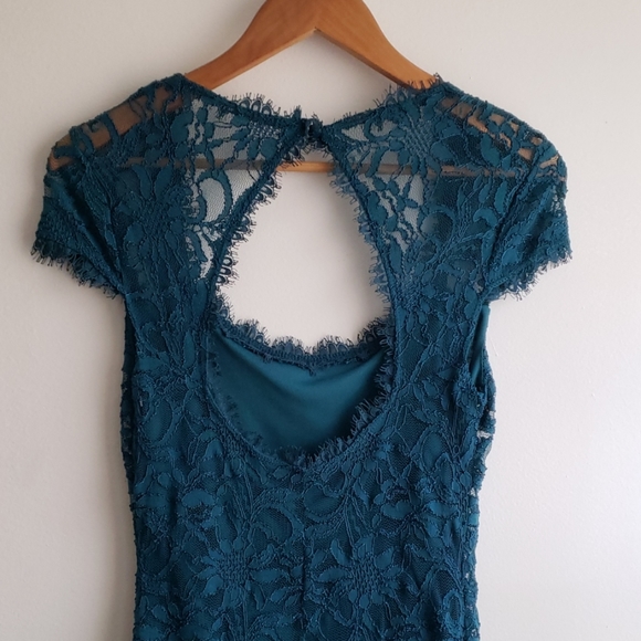 Modcloth teal lace dress with back cut-out - Picture 3 of 8